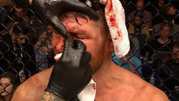 UFC Fight Night 84 - Les suspensions médicales