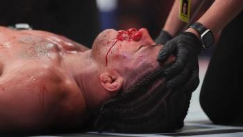 Gilbert Burns ne cherche pas d'excuses après sa défaite par KO à l'UFC 299