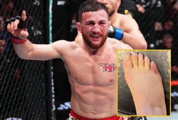 Merab Dvalishvili révèle une blessure à l’orteil avant d’affronter Sean O’Malley