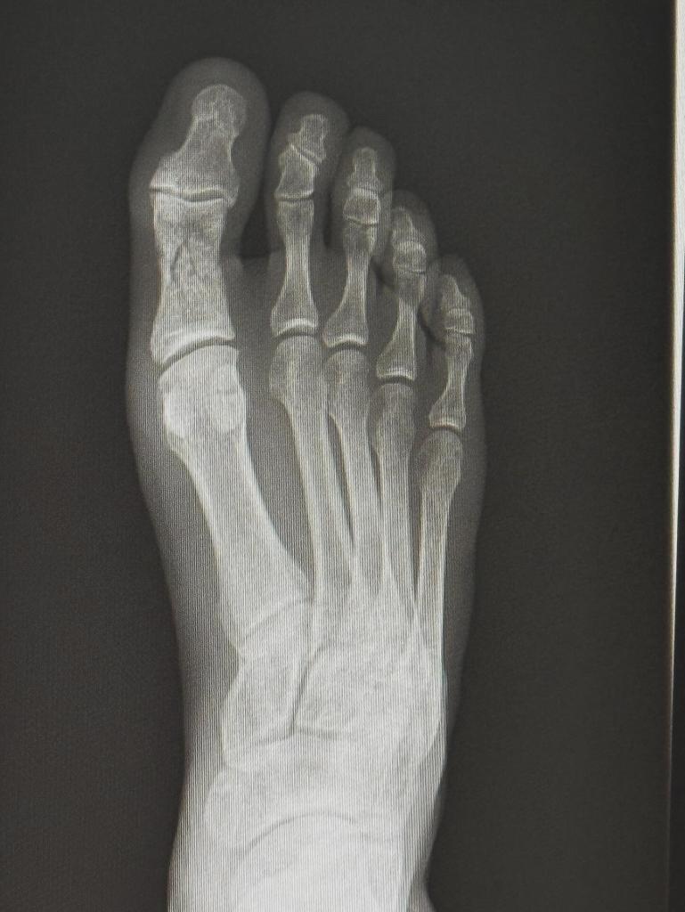 Ikram Aliskerov forfait pour l’UFC 318 après s’être fracturé le pied à l’approche du combat
