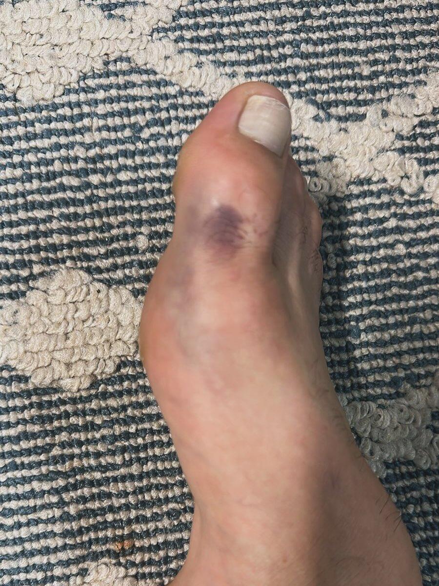 Ikram Aliskerov forfait pour l’UFC 318 après s’être fracturé le pied à l’approche du combat