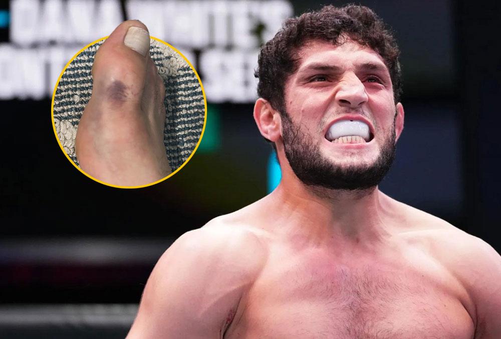 Ikram Aliskerov forfait pour l’UFC 318 après s’être fracturé le pied à l’approche du combat