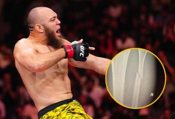 Valter Walker confirme sa blessure : le péroné est fissuré mais l'opération n'est pas nécessaire pour le moment