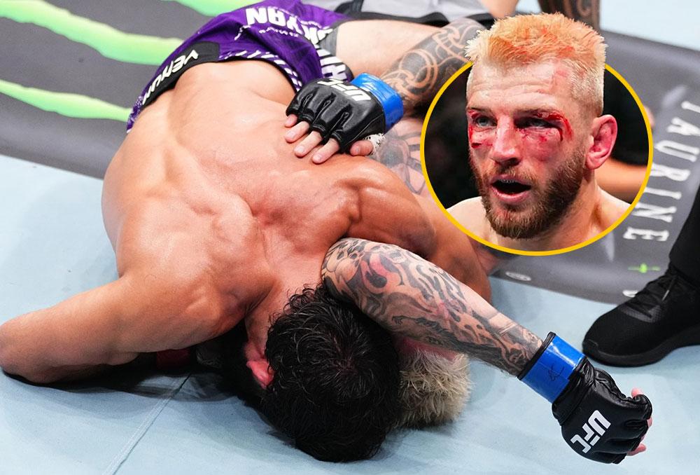 Dan Hooker rassure sur son état de santé et révèle que son nez était déjà cassé avant le main event | UFC Qatar