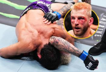 Dan Hooker rassure sur son état de santé et révèle que son nez était déjà cassé avant le main event | UFC Qatar