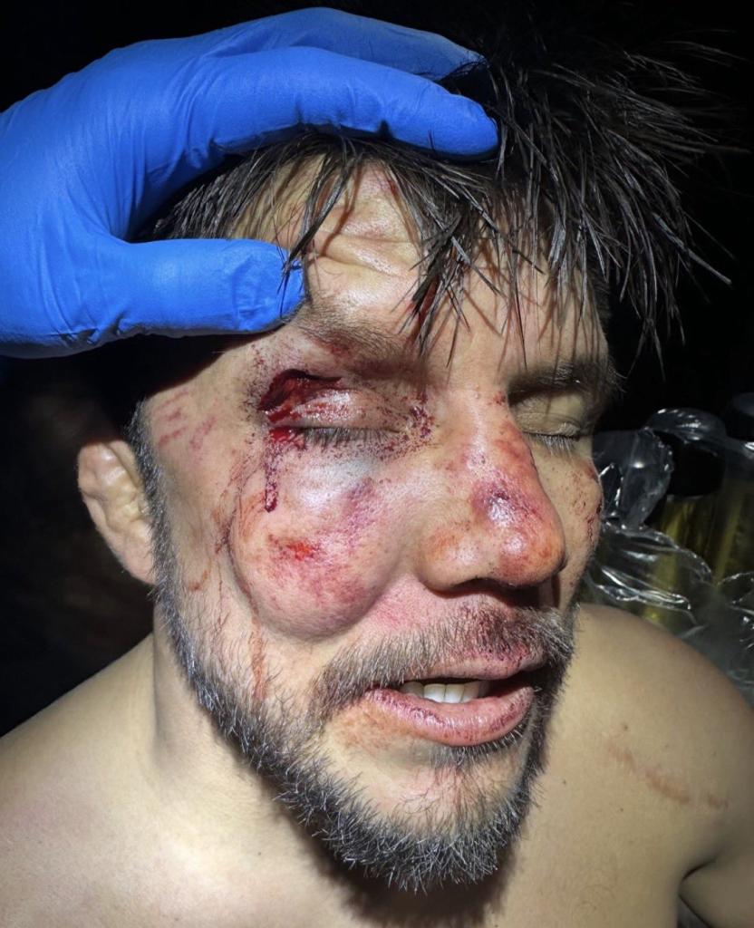 Henry Cejudo rend hommage à Payton Talbott et confirme sa retraite définitive du sport | UFC 323