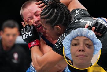 Rose Namajunas subit une opération d’urgence à l’œil après sa défaite contre Natalia Silva à l’UFC 324