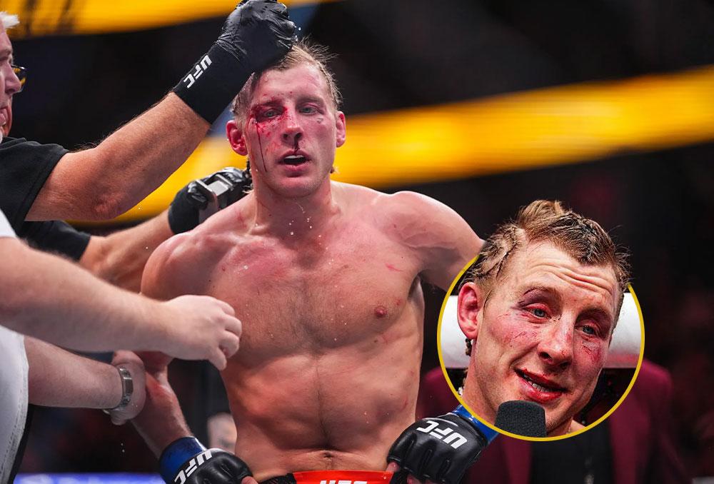 Paddy Pimblett rassure ses fans sur son état de santé une semaine après le choc de l'UFC 324