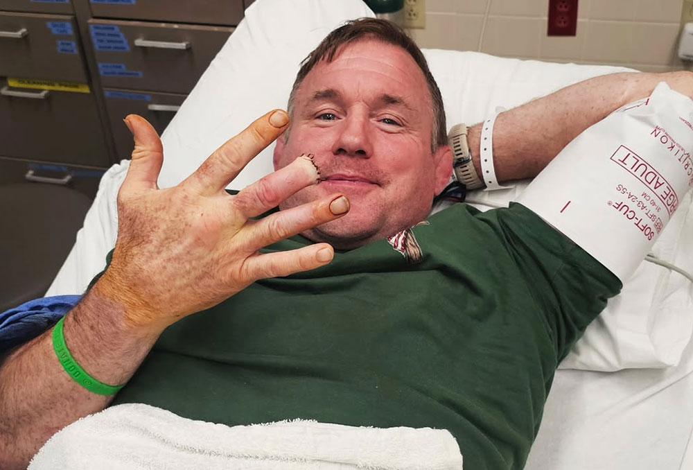 Matt Hughes perd une partie de son doigt mais garde un moral d'acier