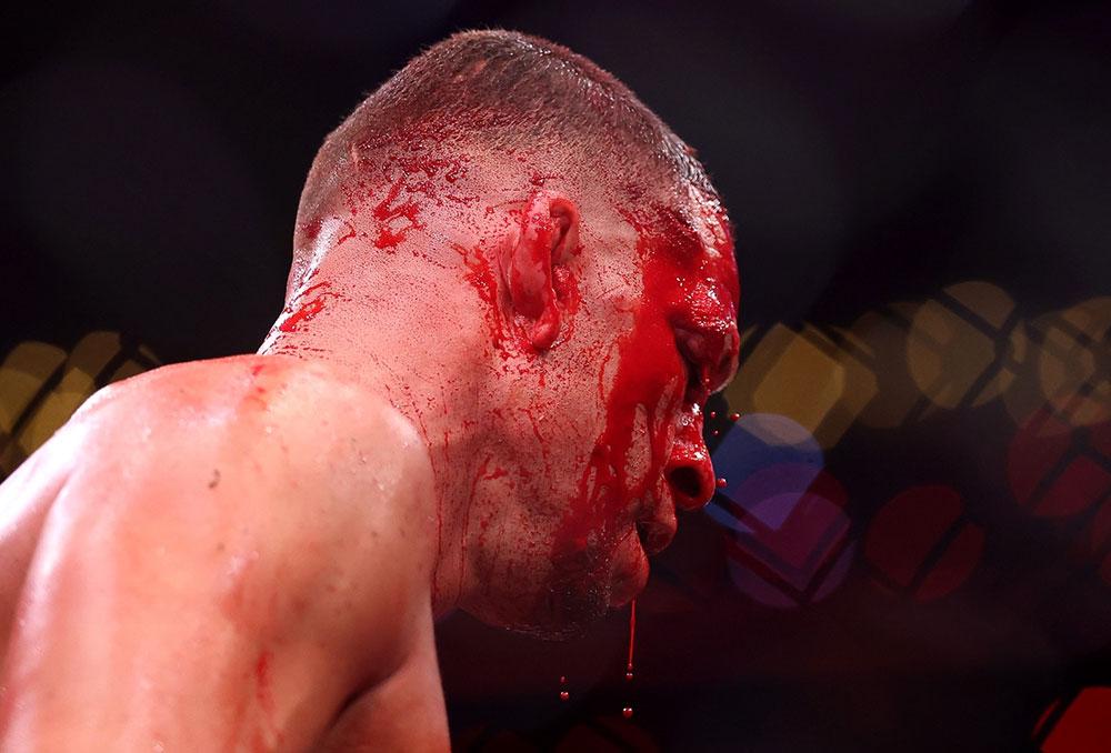 Arrêt de Nate Diaz : Les révélations de Jacob Duran sur les coulisses du carnage