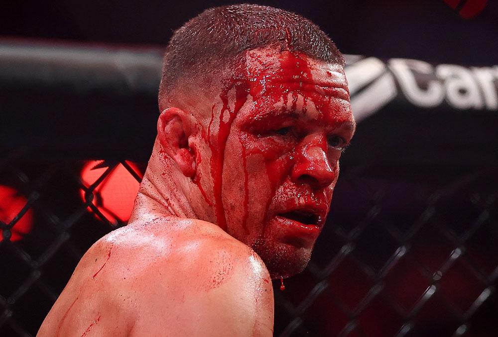 Nate Diaz sort du silence après sa défaite par TKO face à Mike Perry et annonce son retour imminent