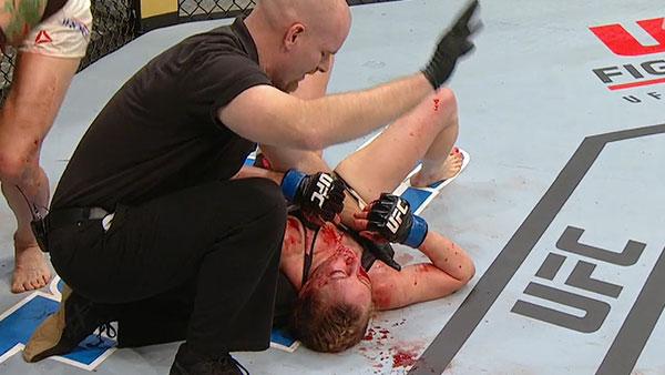 UFC Fight Night 83 - Les suspensions médicales