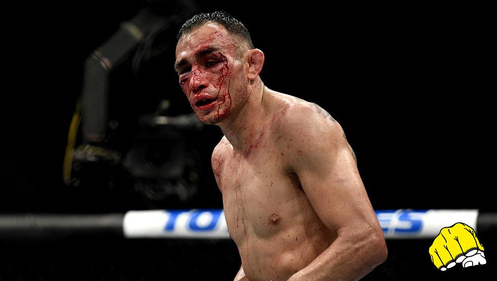 Top Finitions : Tony Ferguson