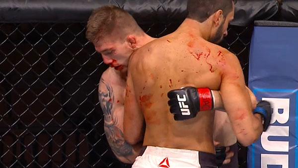 UFC Fight Night 88 - Les suspensions médicales UFC Fight Night 88 - Les suspensions médicales