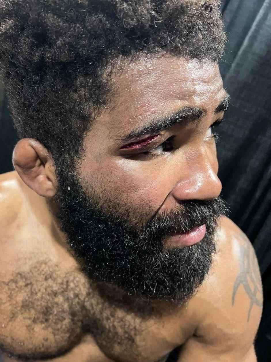 Chris Curtis révèle ses blessures après le choc avec Nassourdine Imavov | UFC 289