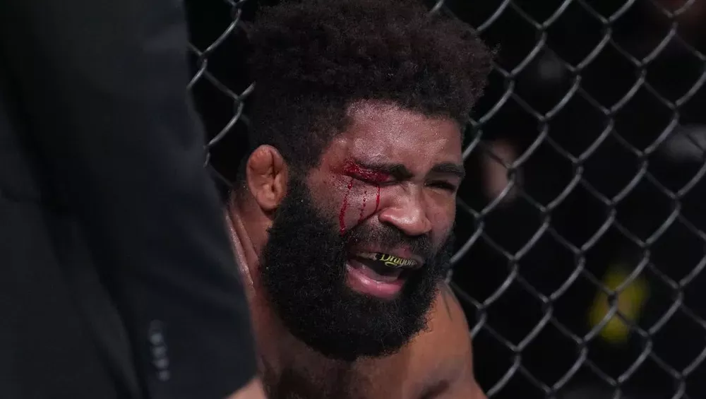 Chris Curtis révèle ses blessures après le choc avec Nassourdine Imavov | UFC 289