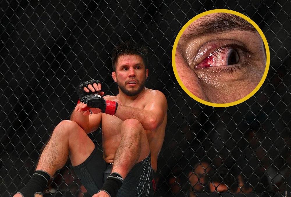 Henry Cejudo envisage de raccrocher les gants après une blessure à l'œil persistante