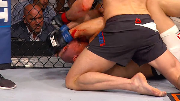 Chris Camozzi contre Vitor Miranda