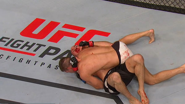 Rory MacDonald contre Stephen Thompson