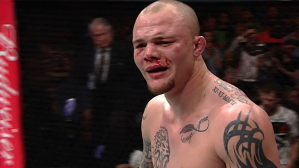 Anthony Smith contre Andrew Sanchez