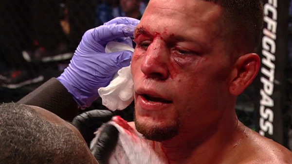 Nate Diaz contre Conor McGregor