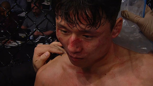 Cub Swanson contre Doo Ho Choi