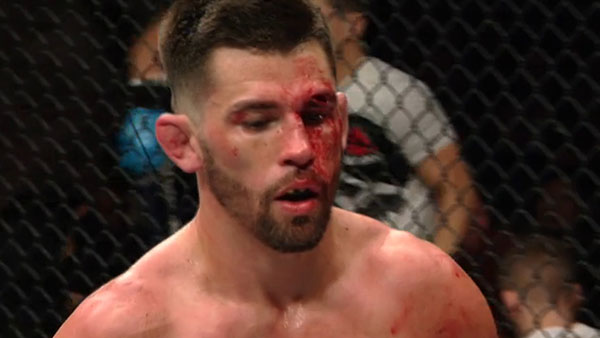 Dominick Cruz contre Cody Garbrandt